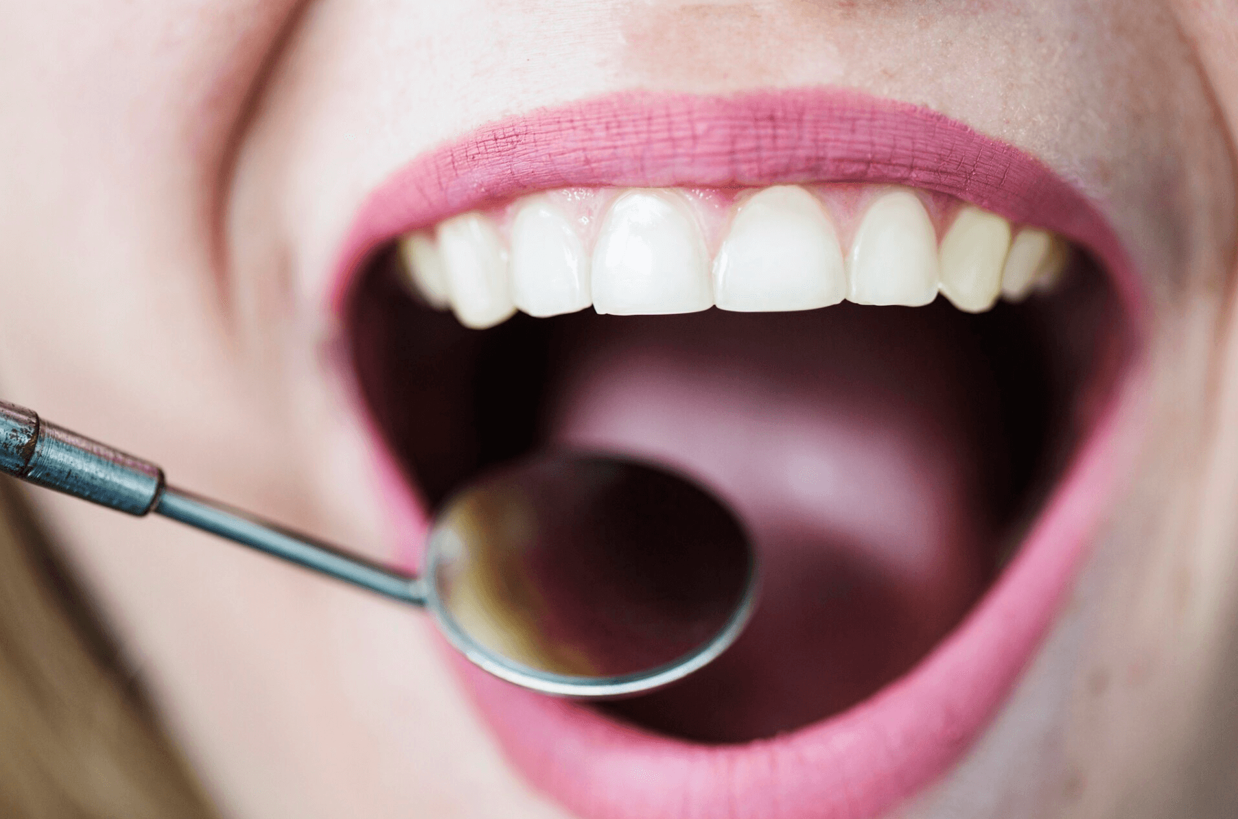 periodoncia